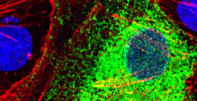 Una herramienta de inteligencia artificial desarrollada en Stanford identifica células sanas y enfermas a partir de la actividad de sus genes