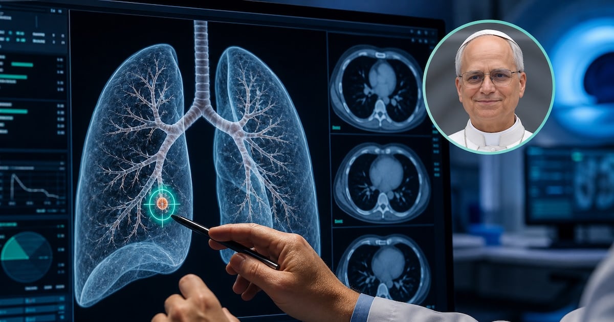 Nódulo pulmonar de tres milímetros: por qué los especialistas recomiendan operar una lesión tan pequeña