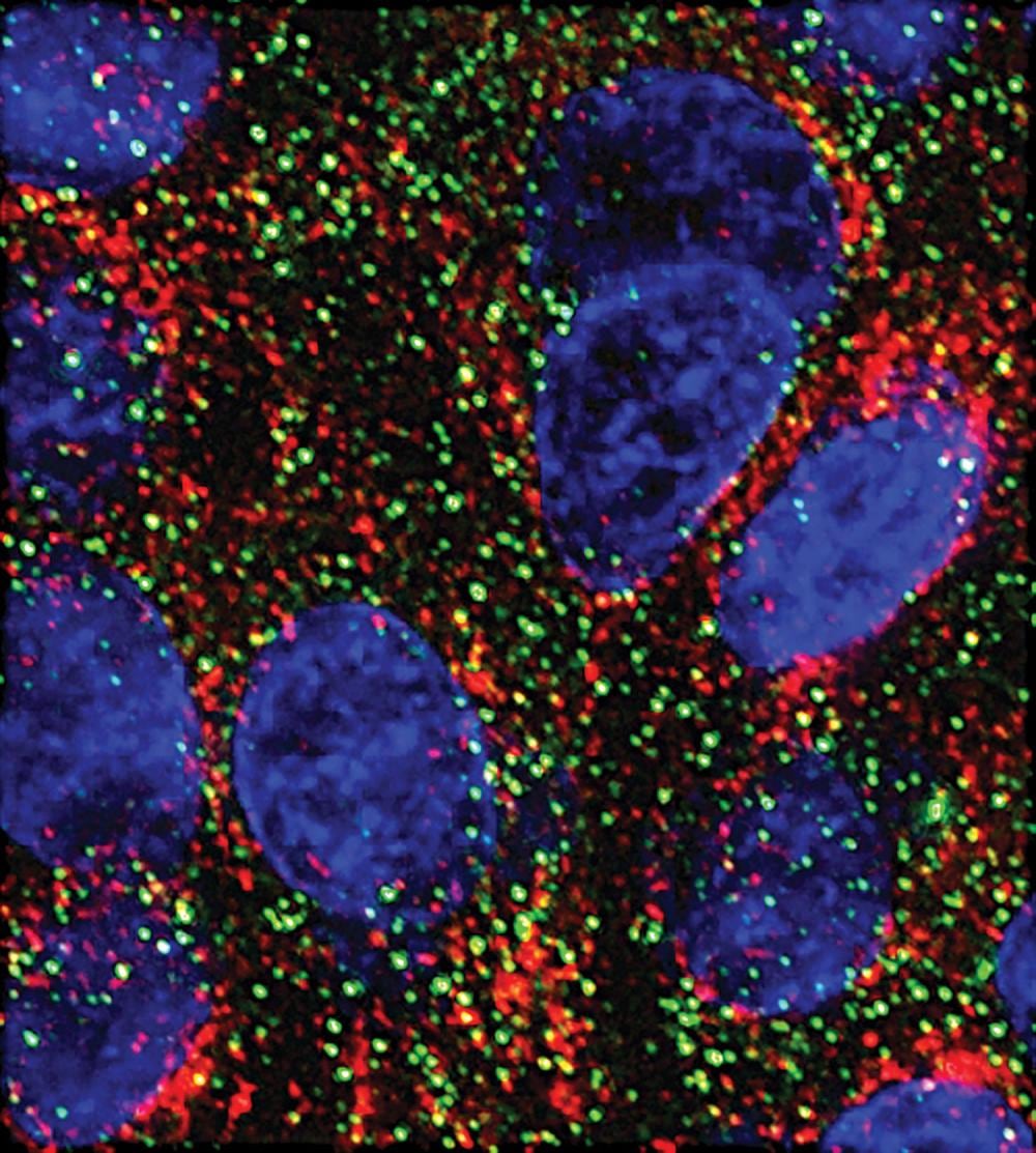 MicroARN frenan el crecimiento de células pancreáticas en un estudio de laboratorio
